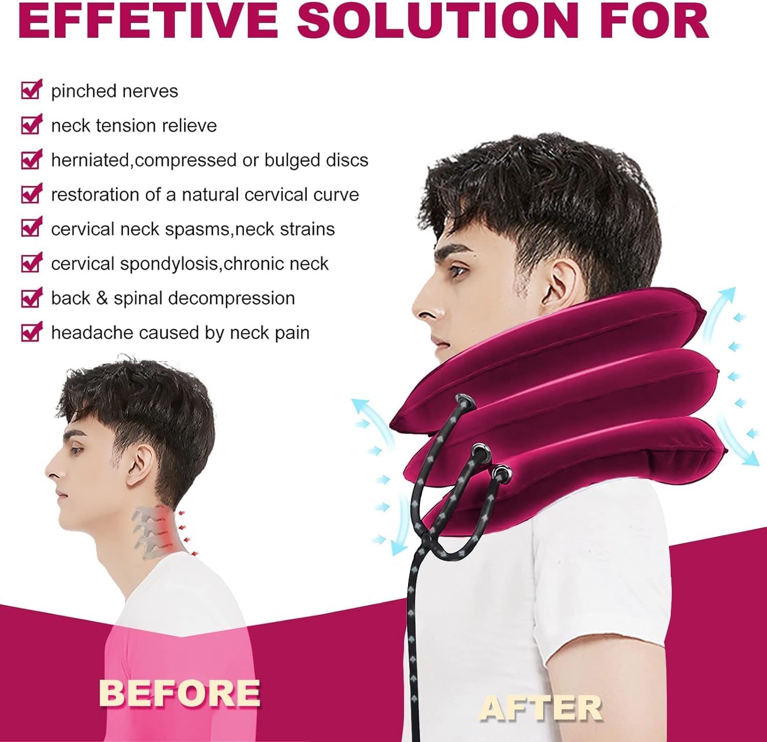 Cervical Neck Traction Device, Neck Stretcher for Neck Pain Relief, Neck Traction Device for Home Use, Neck Decompression Devices, Inflatable Stretcher, Neck Brace & Neck Decompression